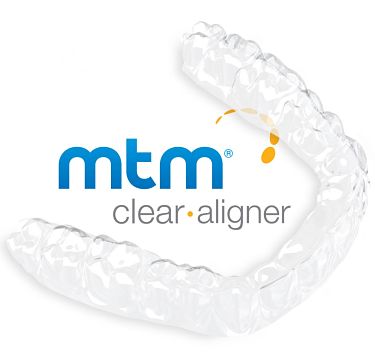 MTM Clear Aligner Treatment