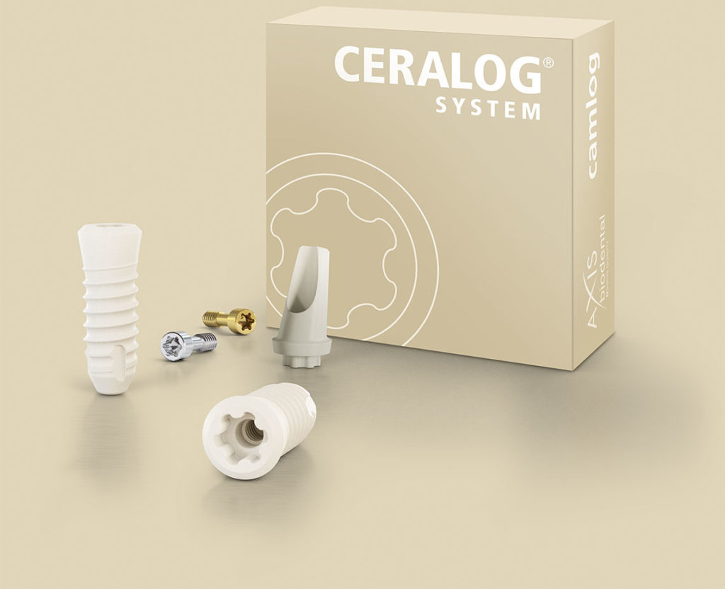 CERALOG Ceramic Dental Implant Treatment